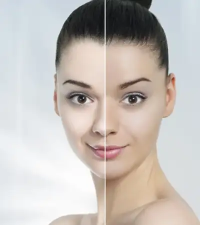 Skin Brightening in Amritsar by Gloss and Glow Studio